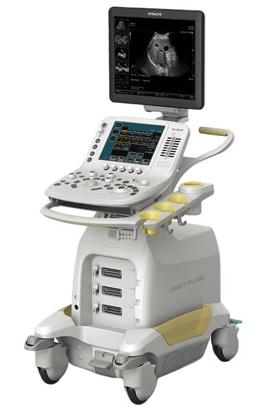УЗИ аппарат Hitachi Arietta V60