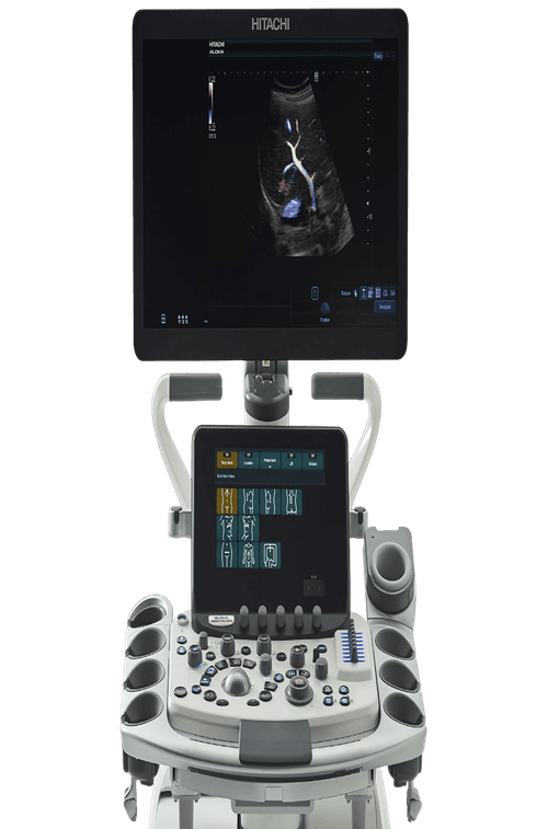 УЗИ аппарат Hitachi Arietta 850