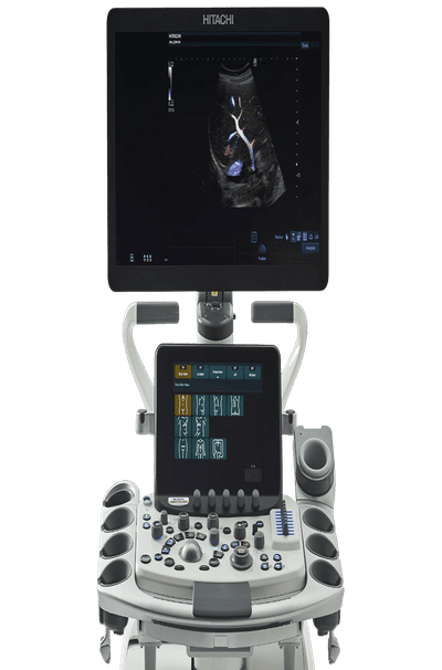 УЗИ аппарат Hitachi Arietta 850