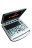 УЗИ аппарат Chison SonoBook 6