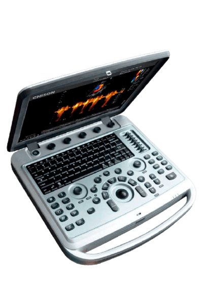 УЗИ аппарат Chison SonoBook 6