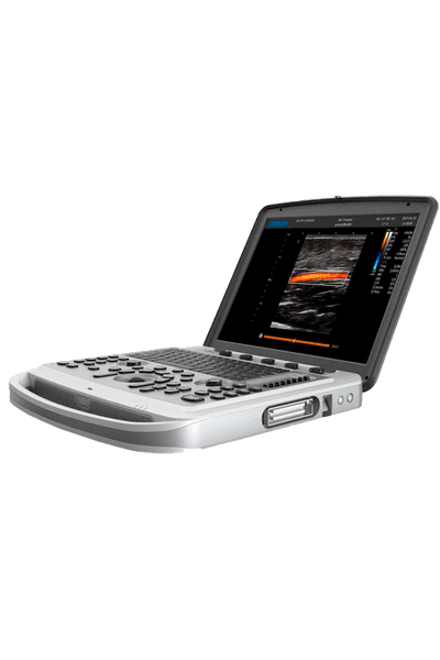 УЗИ аппарат Chison SonoBook 6