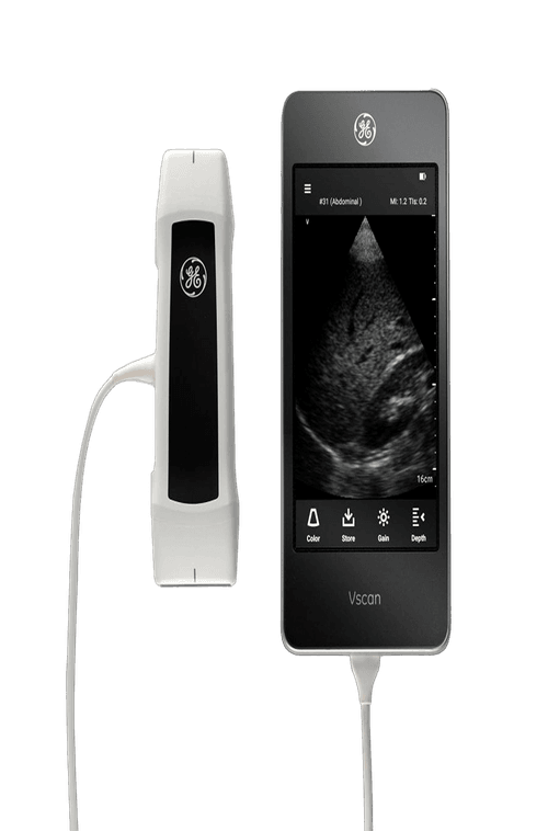 УЗИ аппарат GE Vscan Extend