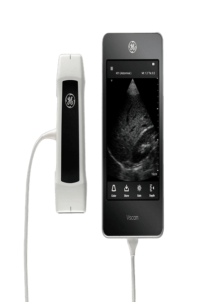 УЗИ аппарат GE Vscan Extend