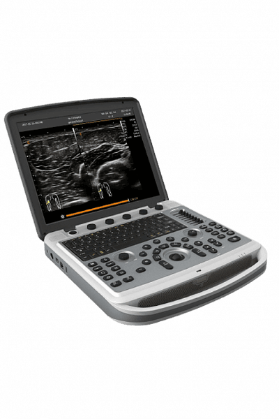 УЗИ аппарат Chison SonoBook 6