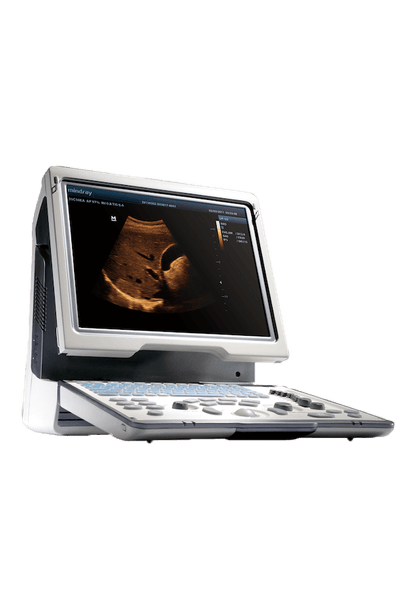 УЗИ аппарат Mindray DP-50 Color